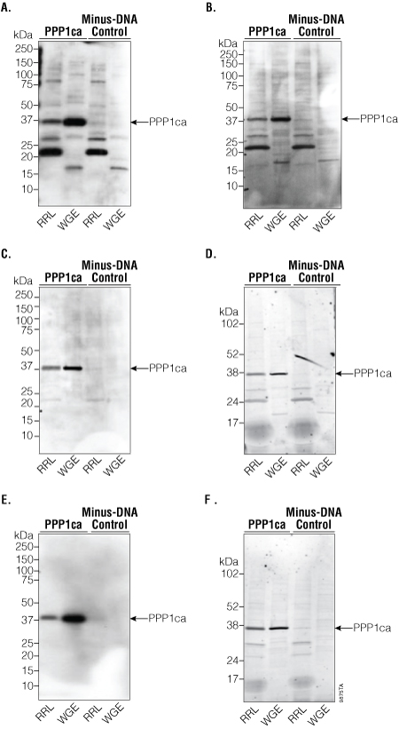 Western blot analysis of PPP1ca.