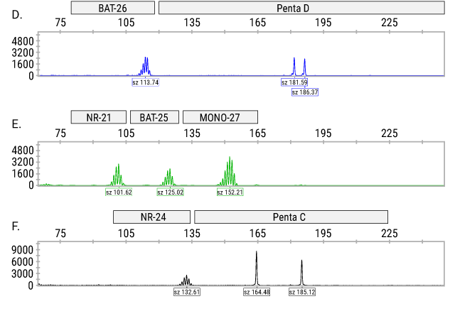 MSI electropharogram for normal tissue